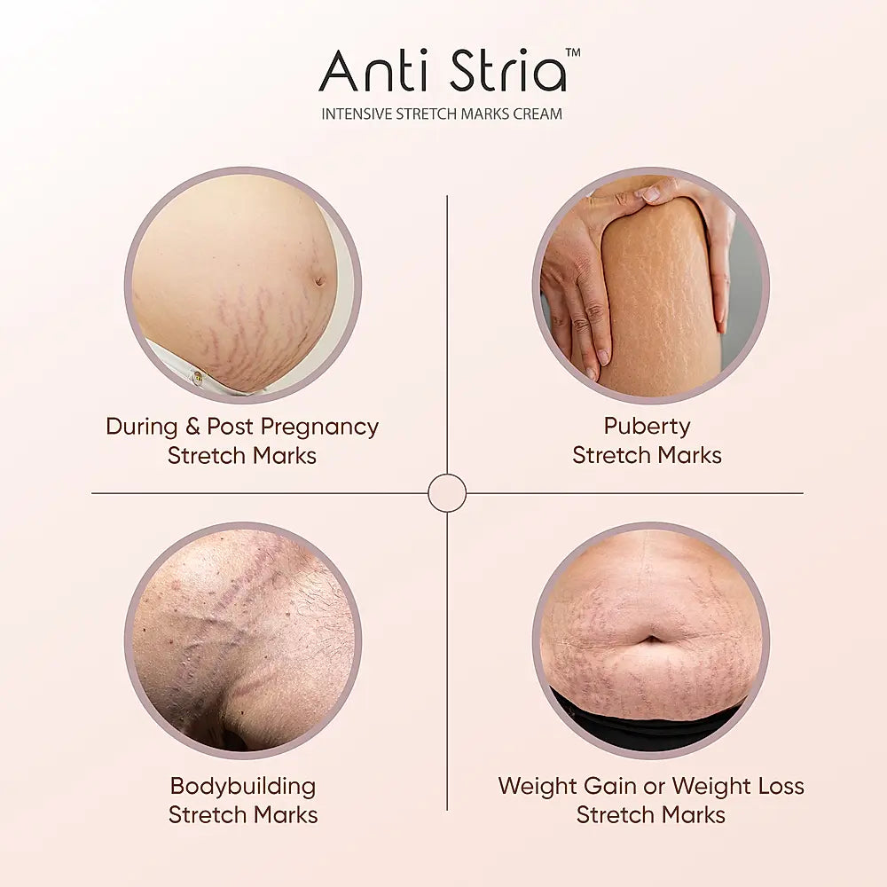 Anti Stria Uses