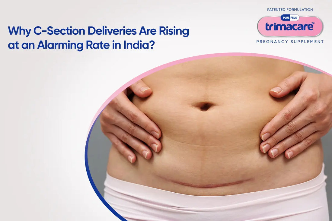 Why C-Section Deliveries Are Rising at an Alarming Rate in India?